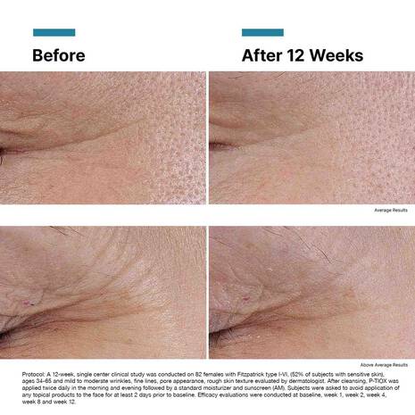 SkinCeuticals P-TIOX Anti-Wrinkle Peptide Serum (1 fl. oz.)