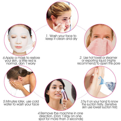Electric Blackhead Remover